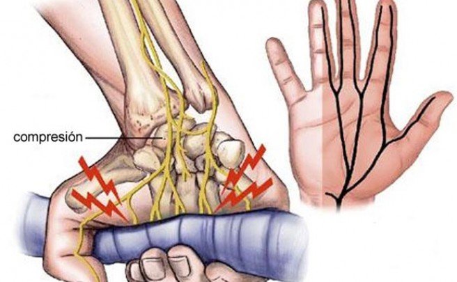 Evitar dolor de manos ciclismo